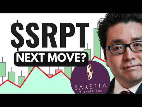 SRPT Stock (Sarepta Therapeutics stock analysis) SRPT STOCK PREDICTION & analysis & news today